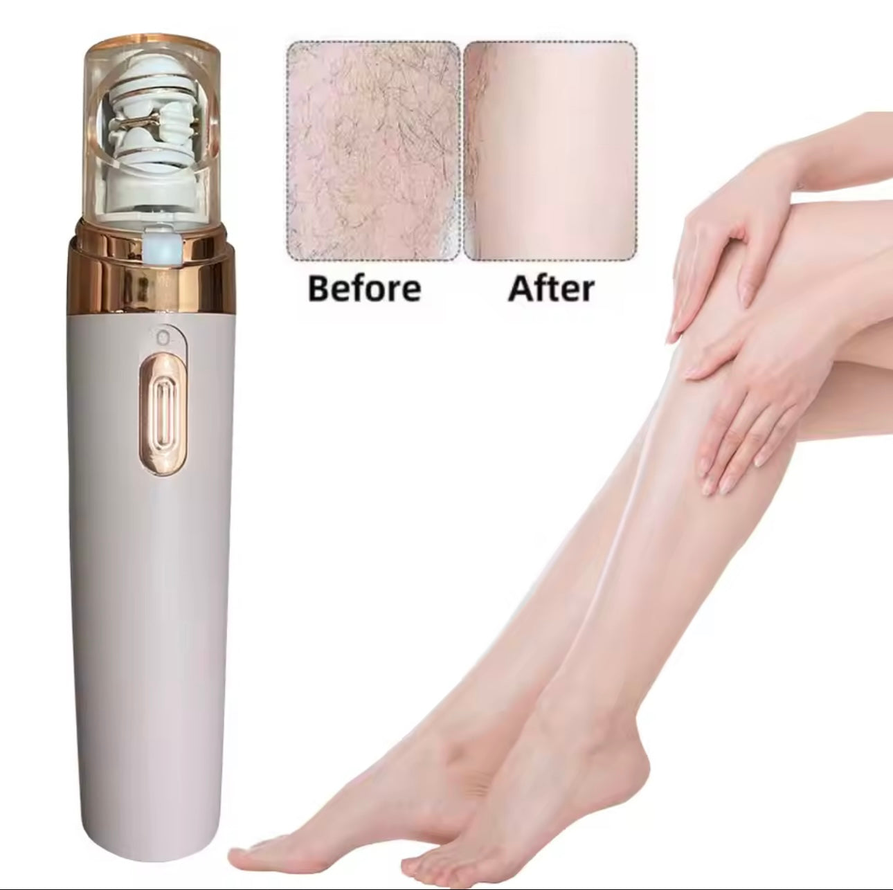 Caedreapromax™ - Hair Epilator