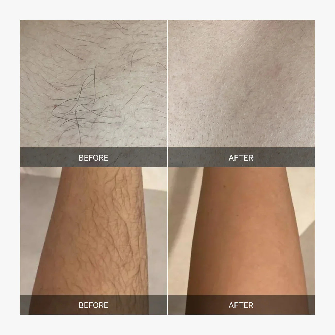 Smoothie™ - Hair trimmer