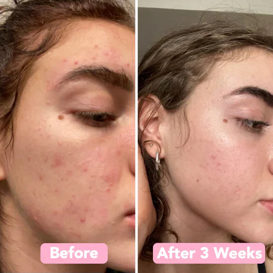 Kojic™ Turmeric & Kojic Acid Pads | 40 Pack