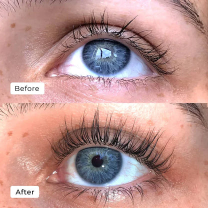Caelash™ Growth Serum
