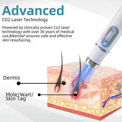 Molde® Non-Invasive Mole and Wart Removal Laser Pen Promax