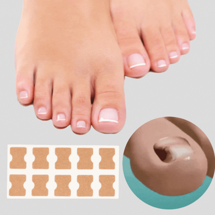 NailPatches™ | Correction Patches for Beautiful and Healthy Nails