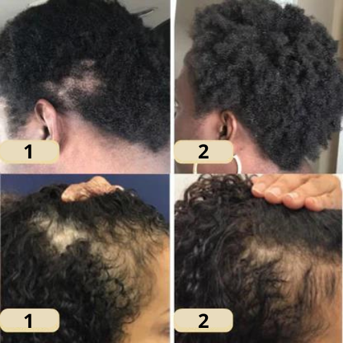 Alicia™ - Natural oil for hair growth