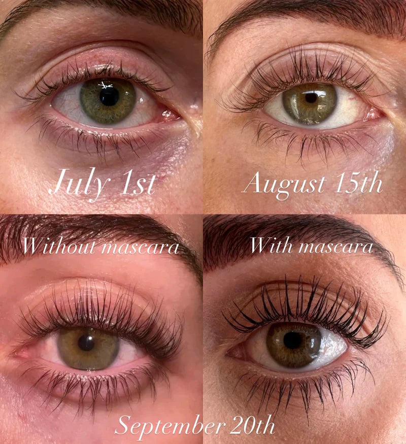 Caelash™ Growth Serum