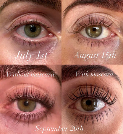 Caelash™ Growth Serum