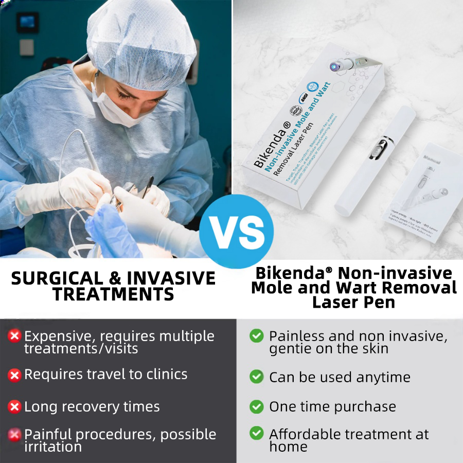 Molde® Non-Invasive Mole and Wart Removal Laser Pen Promax