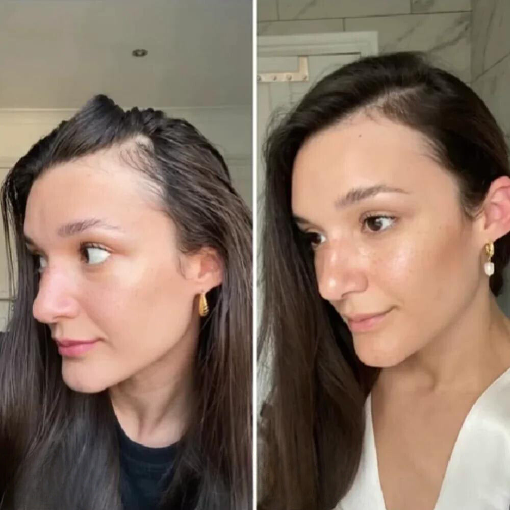 Alicia™ - Natural oil for hair growth