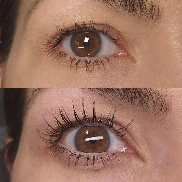 Caelash™ Growth Serum