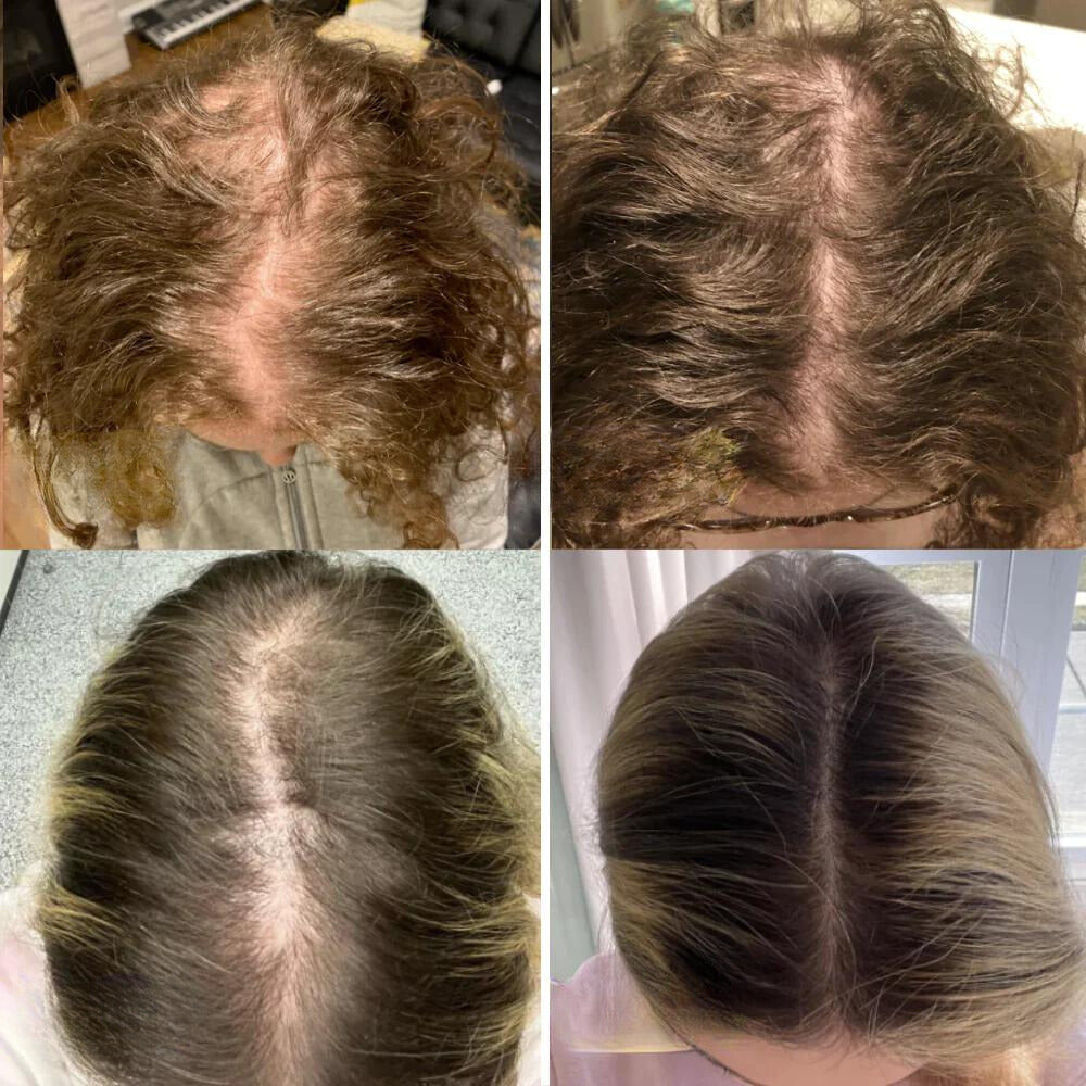 Alicia™ - Natural oil for hair growth