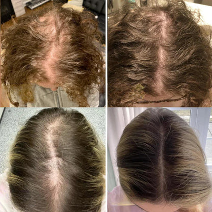 Alicia™ - Natural oil for hair growth