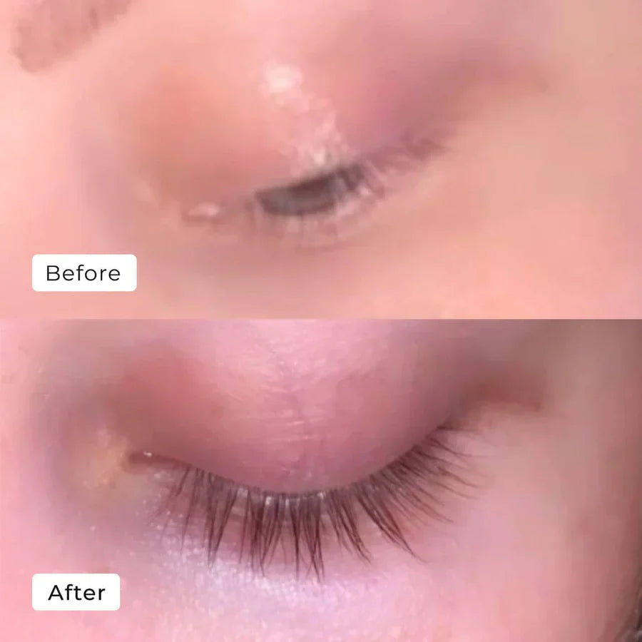Caelash™ Growth Serum