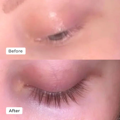 Caelash™ Growth Serum