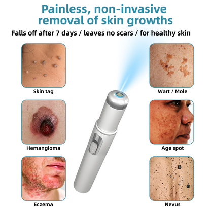 Molde® Non-Invasive Mole and Wart Removal Laser Pen Promax