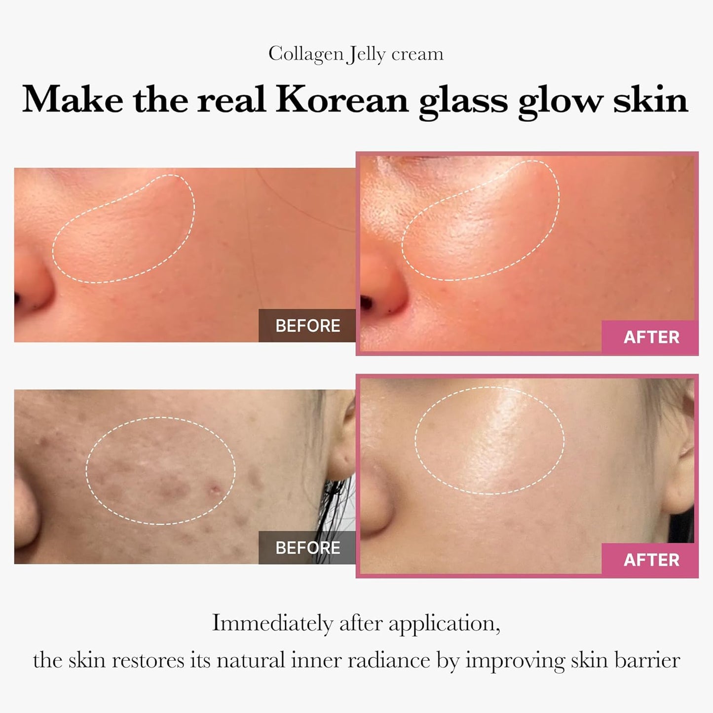 1+1 FREE I Caedrea ™ Collagen Niacinamide Jelly Cream