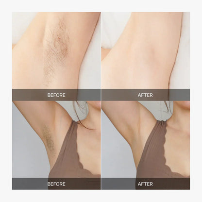 Smoothie™ - Hair trimmer