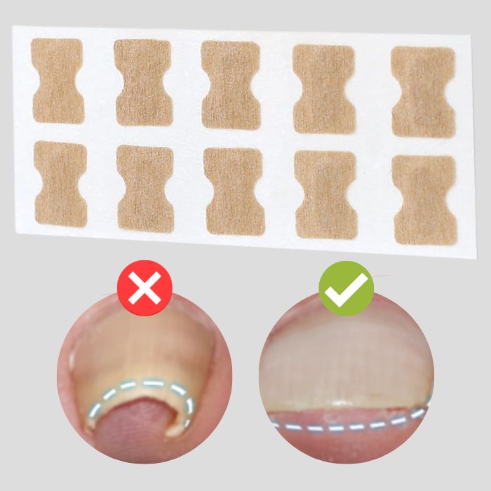 NailPatches™ | Correction Patches for Beautiful and Healthy Nails