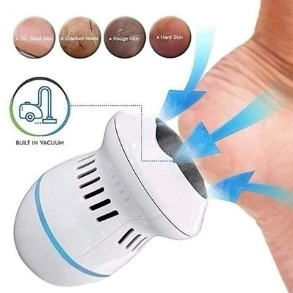 SmoothFeet™ | Transform your pedicure routine