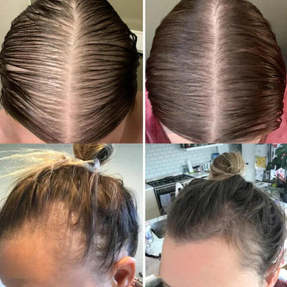 Alicia™ - Natural oil for hair growth