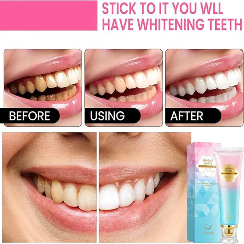 BrightWhite™ - Niacinamide Whitening Toothpaste