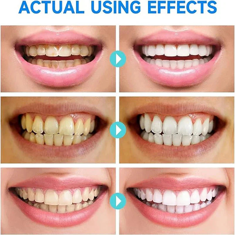 BrightWhite™ - Niacinamide Whitening Toothpaste