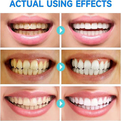 BrightWhite™ - Niacinamide Whitening Toothpaste